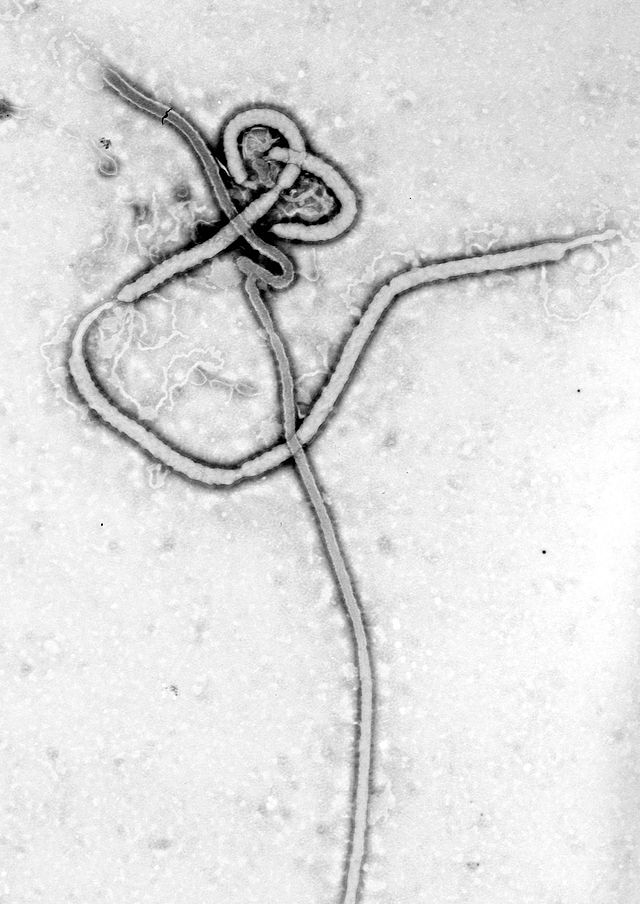  photo Ebola_virus_em_zps73fec8d2.jpg